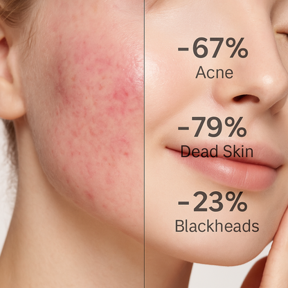 Veron - Radiant Orange Enzyme Exfoliating Gel